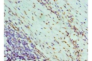Immunohistochemistry of paraffin-embedded human colon cancer using ABIN7161690 at dilution of 1:100 (NONO 抗体  (AA 1-300))