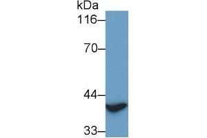 Detection of TITF1 in Rat Heart lysate using Polyclonal Antibody to Thyroid Transcription Factor 1 (TITF1) (NKX2-1 抗体)