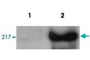 HeLa cells were transfected with CHD5 and analysed by Western blot. (CHD5 抗体)