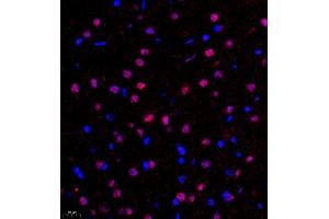 Immunofluorescence (Paraffin-embedded Sections) (IF (p)) image for anti-Fibroblast Growth Factor 11 (FGF11) antibody (ABIN7073941)