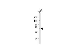 Anti-MLLT1 Antibody at 1:2000 dilution + Hela whole cell lysates Lysates/proteins at 20 μg per lane. (MLLT1 抗体  (C-Term))