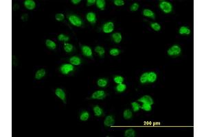 Immunofluorescence of monoclonal antibody to SIX4 on HeLa cell. (SIX4 抗体  (AA 672-780))