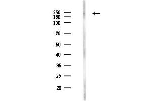 Western blot analysis of lysates from HUVEC cells(LPS,4h treatment), using CH Antibody at 1/1000 dilution.