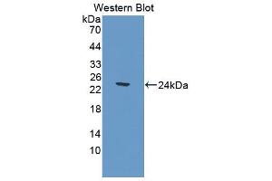 Western blot analysis of the recombinant protein. (CNDP1 抗体  (AA 332-507))