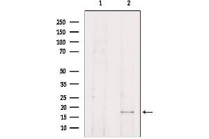Western blot analysis of extracts from HepG2, using TP53I11 Antibody. (TP53I11 抗体  (N-Term))