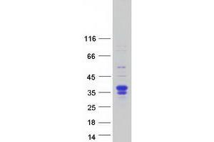 Western Blotting (WB) image for Follistatin-Like 3 (Secreted Glycoprotein) (FSTL3) protein (Myc-DYKDDDDK Tag) (ABIN2721306)