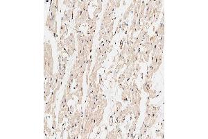 Immunohistochemical analysis of paraffin-embedded human heart tissue using (ABIN1538329 and ABIN2849397) performed on the Leica® BOND RXm. (CALCRL 抗体  (AA 340-367))