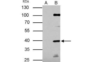 IP Image E2F1 antibody [N1N3] immunoprecipitates E2F1 protein in IP experiments. (E2F1 抗体)