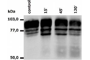 Western Blotting analysis of PMA-activated neutrophils (Fig. (Integrin beta 2 抗体  (PE))