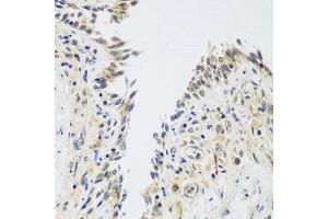 Immunohistochemistry of paraffin-embedded human lung using UPF2 antibody at dilution of 1:100 (40x lens). (RENT2/UPF2 抗体)