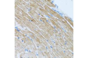 Immunohistochemistry of paraffin-embedded mouse heart using CCL2 antibody at dilution of 1:100 (40x lens). (CCL2 抗体)