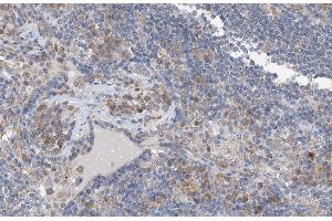 ABIN6267456 at 1/100 staining human Lymphoma tissue sections by IHC-P.