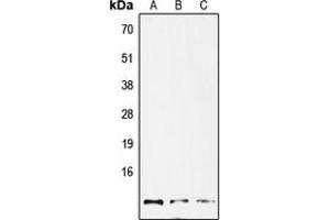 Western blot analysis of GNG12 expression in HepG2 (A), mouse lung (B), rat lung (C) whole cell lysates. (GNG12 抗体  (Center))