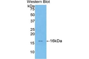 Detection of Recombinant TGFb1, Rat using Polyclonal Antibody to Transforming Growth Factor Beta 1 (TGFb1) (TGFB1 抗体  (AA 279-390))