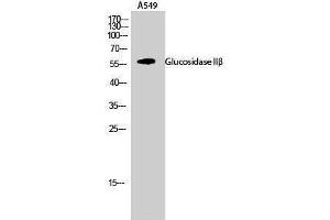Western Blotting (WB) image for anti-Glucosidase, beta (Bile Acid) 2 (GBA2) (Internal Region) antibody (ABIN3175282) (GBA2 抗体  (Internal Region))