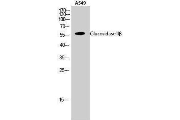 GBA2 anticorps  (Internal Region)