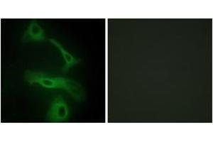 Immunofluorescence analysis of HeLa cells, using CLUS Antibody. (Clusterin 抗体  (AA 400-449))