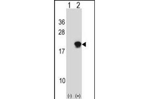 Western blot analysis of SUMO4 (arrow) using rabbit polyclonal SUMO4 Antibody (Center) (ABIN388077 and ABIN2845831). (SUMO4 抗体)