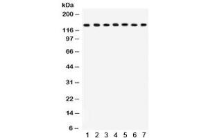 Western blot testing of 1) rat lung, 2) mouse lung, 3) HeLa, 4) MM231, 5) COLO320, 6) A549 and 7) mouse NIH3T3 lysate with SAP97 antibody. (DLG1 抗体  (AA 1-165))