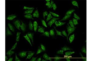 Immunofluorescence of monoclonal antibody to RPL19 on HeLa cell. (RPL19 抗体  (AA 1-100))