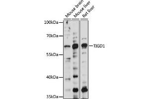 Western blot analysis of extracts of various cell lines, using TIGD1 antibody (ABIN7270828) at 1000 dilution. (TIGD1 抗体  (AA 1-300))
