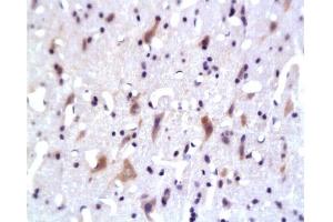 Formalin-fixed and paraffin embedded: rat brain tissue labeled with Anti-PKB Polyclonal Antibody, Unconjugated 1:200 followed by conjugation to the secondary antibody and DAB staining (AKT1/3 (AA 401-479) 抗体)