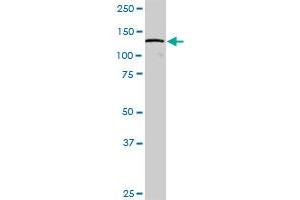 DDX42 MaxPab polyclonal antibody. (DDX42 抗体  (AA 1-819))