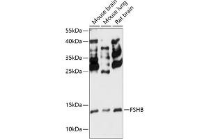 Western blot analysis of extracts of various cell lines, using FSHB antibody (ABIN7267225) at 1:3000 dilution. (FSHB 抗体  (AA 19-129))