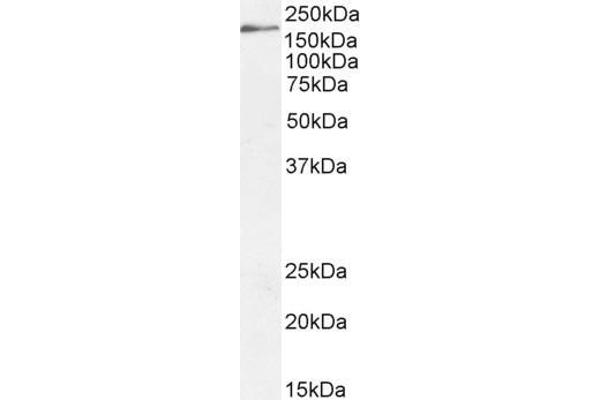 DSCAM 抗体  (Internal Region)