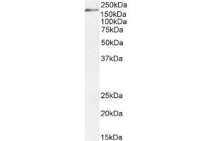 ABIN185687 (2µg/ml) staining of HepG2 cell lysate (35µg protein in RIPA buffer). (DSCAM 抗体  (Internal Region))