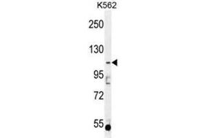 AGBL5 Antibody (N-term) western blot analysis in K562 cell line lysates (35µg/lane). (AGBL5 抗体  (N-Term))