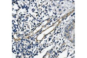 IHC analysis of CD31/PECAM1 using anti-CD31/PECAM1 antibody (ABIN7601076). (CD31 抗体  (AA 28-382))
