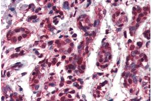 Human Breast (formalin-fixed, paraffin-embedded) stained with TCF3 antibody ABIN461942 at 3. (TCF3 抗体  (AA 522-535))