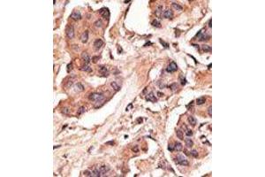 Image no. 2 for anti-Melanoma Antigen Family H, 1 (MAGEH1) (C-Term) antibody (ABIN358661) (MAGEH1 抗体  (C-Term))