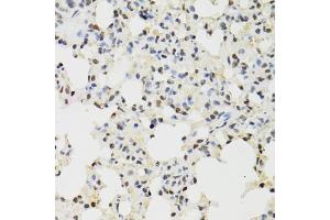 Immunohistochemistry of paraffin-embedded mouse lung using KDM4A antibody (ABIN6131821, ABIN6142793, ABIN6142795 and ABIN6223960) at dilution of 1:100 (40x lens). (KDM4A 抗体  (AA 585-815))