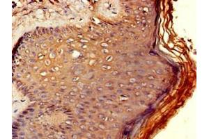 Immunohistochemistry (IHC) image for anti-Regulator of Chromosome Condensation (RCC1) and BTB (POZ) Domain Containing Protein 2 (RCBTB2) (AA 1-200) antibody (ABIN7167421)