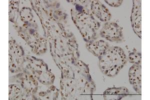 Immunoperoxidase of monoclonal antibody to SMC6L1 on formalin-fixed paraffin-embedded human placenta. (SMC6 抗体  (AA 1-110))