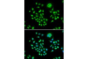Immunofluorescence analysis of HeLa cells using AGFG1 antibody (ABIN6293682). (AGFG1 抗体)