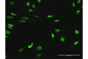Immunofluorescence of purified MaxPab antibody to MYNN on HeLa cell. (Myoneurin 抗体  (AA 1-610))