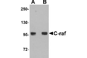 Western blot analysis of C-raf in 3T3 cell lysate with C-raf antibody at (A) 0. (RAF1 抗体  (N-Term))