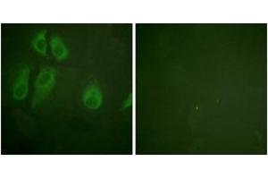 Immunofluorescence analysis of HeLa cells, using IL-2R alpha/CD25 (Ab-268) Antibody. (CD25 抗体  (AA 223-272))