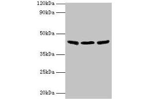 Western blot All lanes: IDH3B antibody at 2 μg/mL Lane 1: Hela whole cell lysate Lane 2: Mouse kidney tissue Lane 3: Mouse gonadal tissue Secondary Goat polyclonal to rabbit IgG at 1/10000 dilution Predicted band size: 43, 42, 26 kDa Observed band size: 43 kDa (IDH3B 抗体  (AA 35-385))