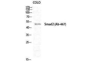 Western Blotting (WB) image for anti-SMAD, Mothers Against DPP Homolog 2 (SMAD2) (Ser80) antibody (ABIN3186987) (SMAD2 抗体  (Ser80))