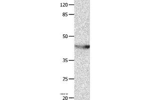 Western blot analysis of Mouse spleen tissue, using KCNA5 Polyclonal Antibody at dilution of 1:700 (KCNA5 抗体)