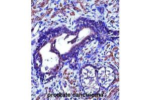 Immunohistochemistry (IHC) image for anti-Actin, gamma 2, Smooth Muscle, Enteric (ACTG2) antibody (ABIN2997383) (ACTG2 抗体)