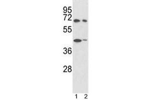 Western Blotting (WB) image for anti-Protein tyrosine Phosphatase, Non-Receptor Type 11 (PTPN11) (AA 526-551) antibody (ABIN3032394)