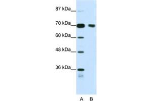 Western Blotting (WB) image for anti-Tripartite Motif Containing 32 (TRIM32) antibody (ABIN2461827) (TRIM32 抗体)