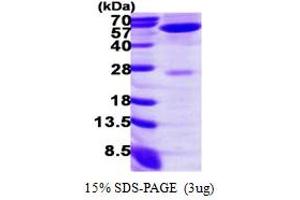 Alanine Aminotransferase (ALT) (AA 1-496) protein (His tag)