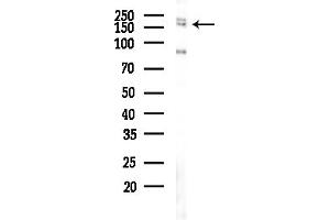 anti-Eukaryotic Translation Initiation Factor 3 Subunit A (EIF3A) (C-Term) antibody