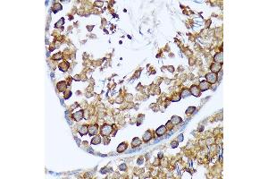 Immunohistochemistry of paraffin-embedded rat testis using T Rabbit mAb (ABIN7270916) at dilution of 1:100 (40x lens). (TACC3 抗体)